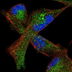 GLT8D2 Antibody, Novus Biologicals 25 &mu;L; Unlabeled:Antibodies, Polyclonal